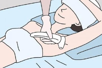 使用家用光子脫毛儀，你需要知道這幾點