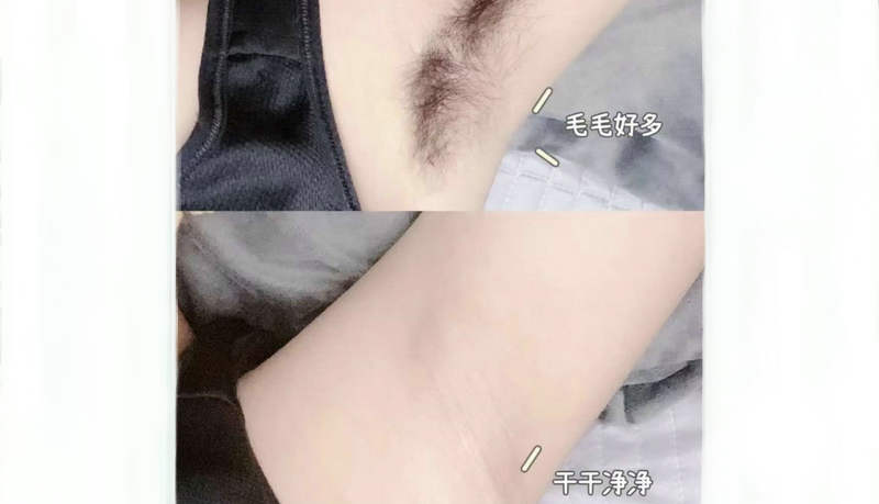 秋天脫毛有什么好處嗎？(圖1)